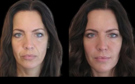 Best Plastic Surgeon in dubai forJawline Fillers: Enhancing Your Facial Balance with Ease