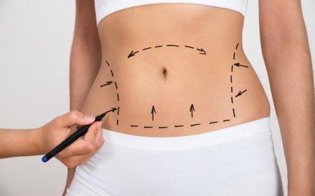 When to Choose Liposuction Timing Tips from Best Surgeons in Dubai