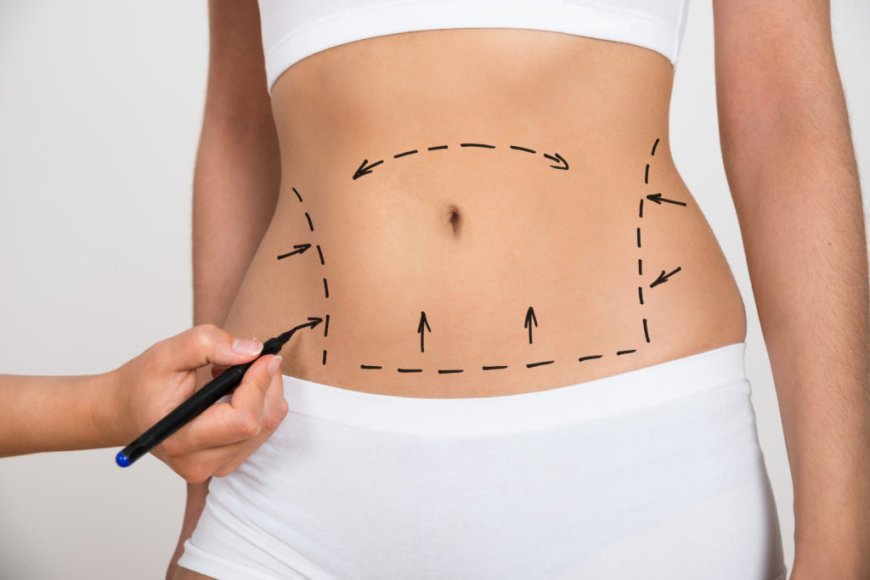 When to Choose Liposuction Timing Tips from Best Surgeons in Dubai