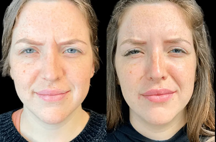 Innovative Skincare Treatments Only at the Best Aesthetic Clinic in Dubai