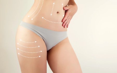Smart Choices Start Here Key Questions Before Liposuction Surgery in Dubai