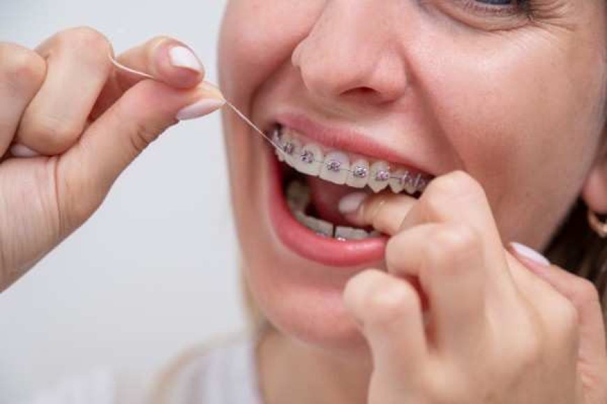 Types of Braces You May Not Have Thought to Ask About