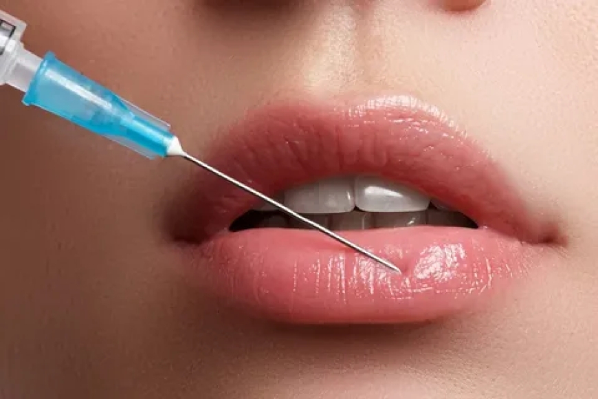 Embrace Confidence with Lip Fillers in Plano, Texas