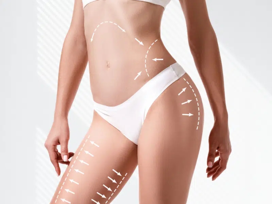 Who Is the Ideal Candidate for a Mini Tummy Tuck Dubai?